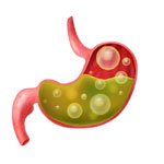 Gas Acidity Constipation